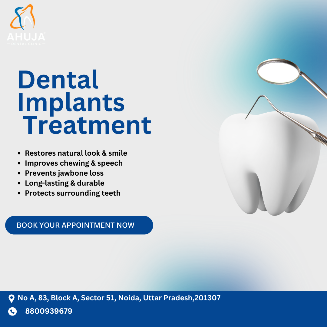 Best Dental Implants Treatment