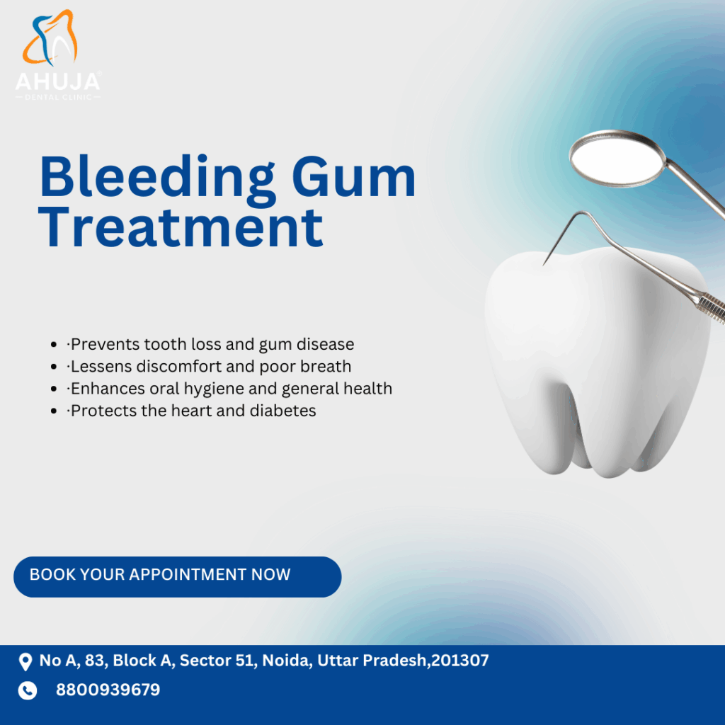 Bleeding Gums Treatment