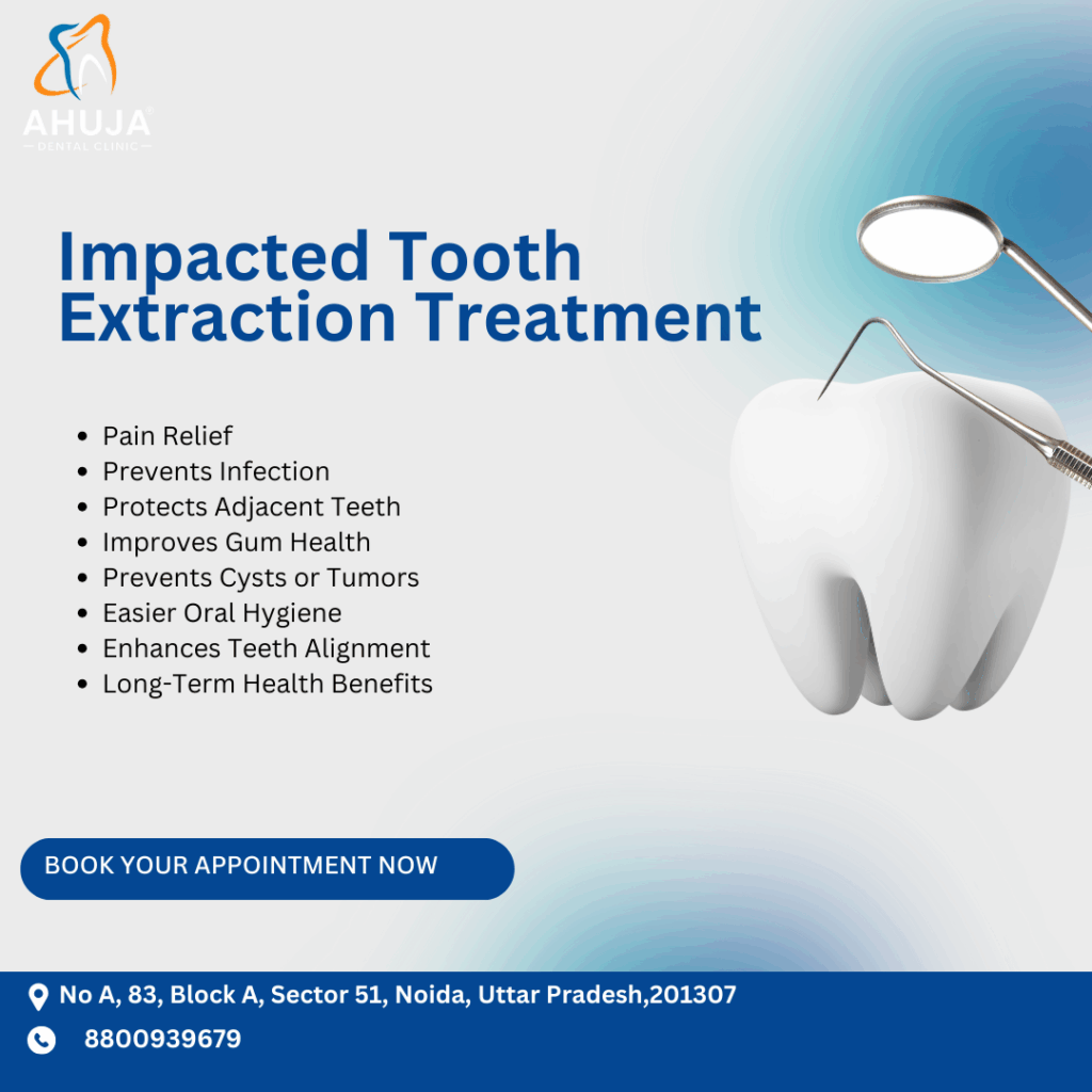 Impacted tooth extraction