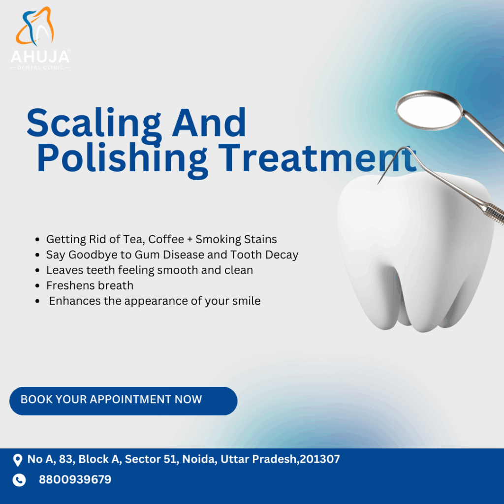 Scaling & Polishing