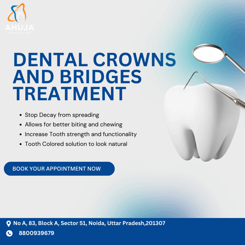 Dental Crowns And Bridges Treatment
