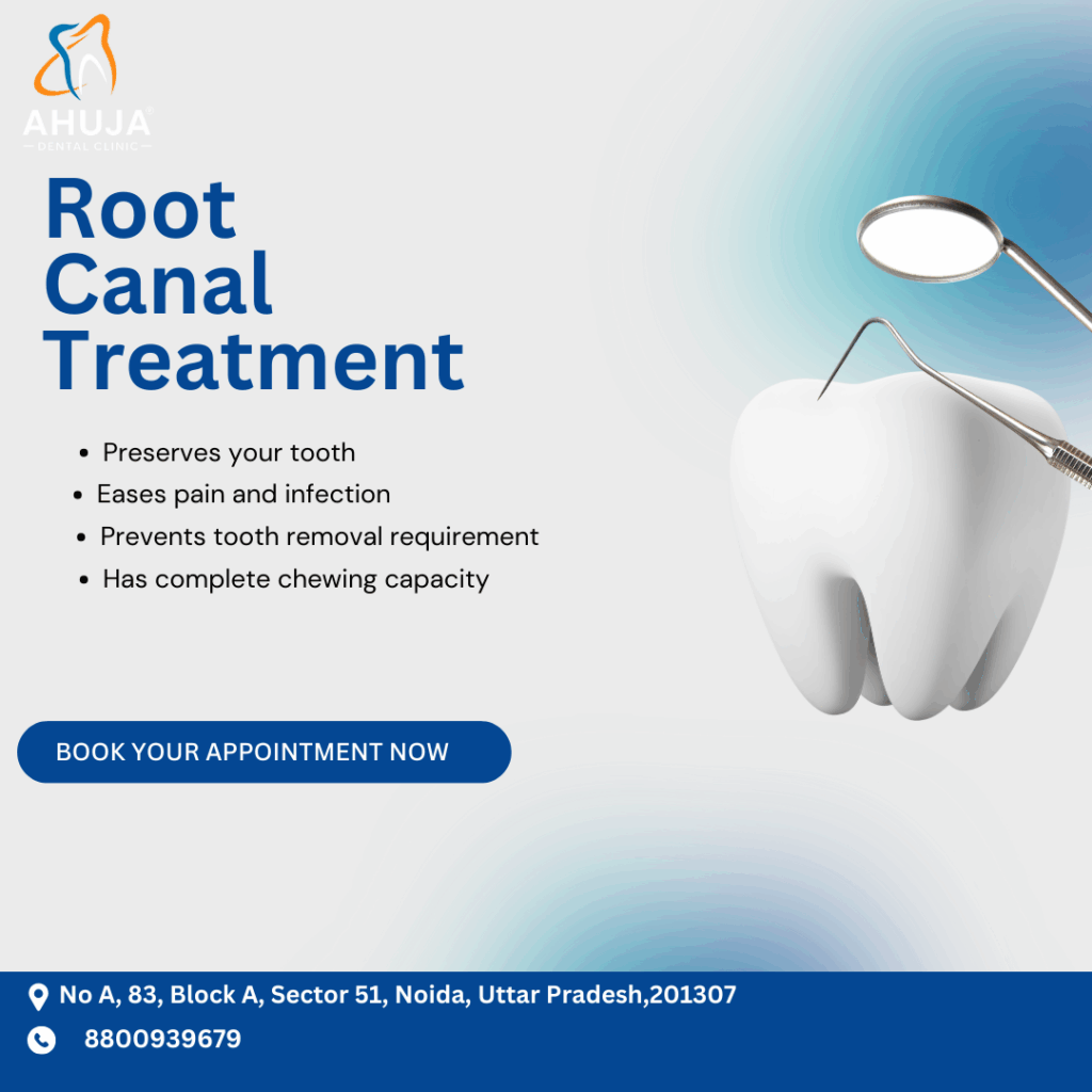 Root Canal Treatment (RCT)