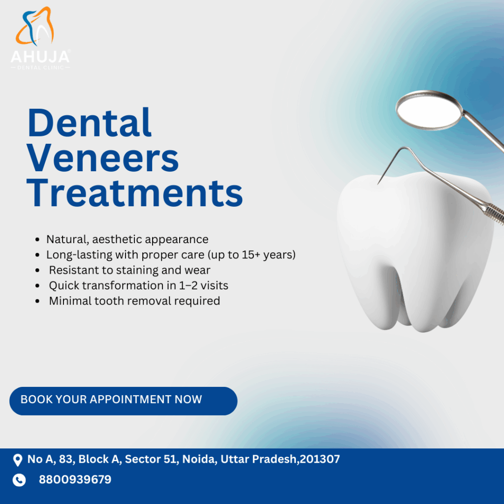 Dental veneers
