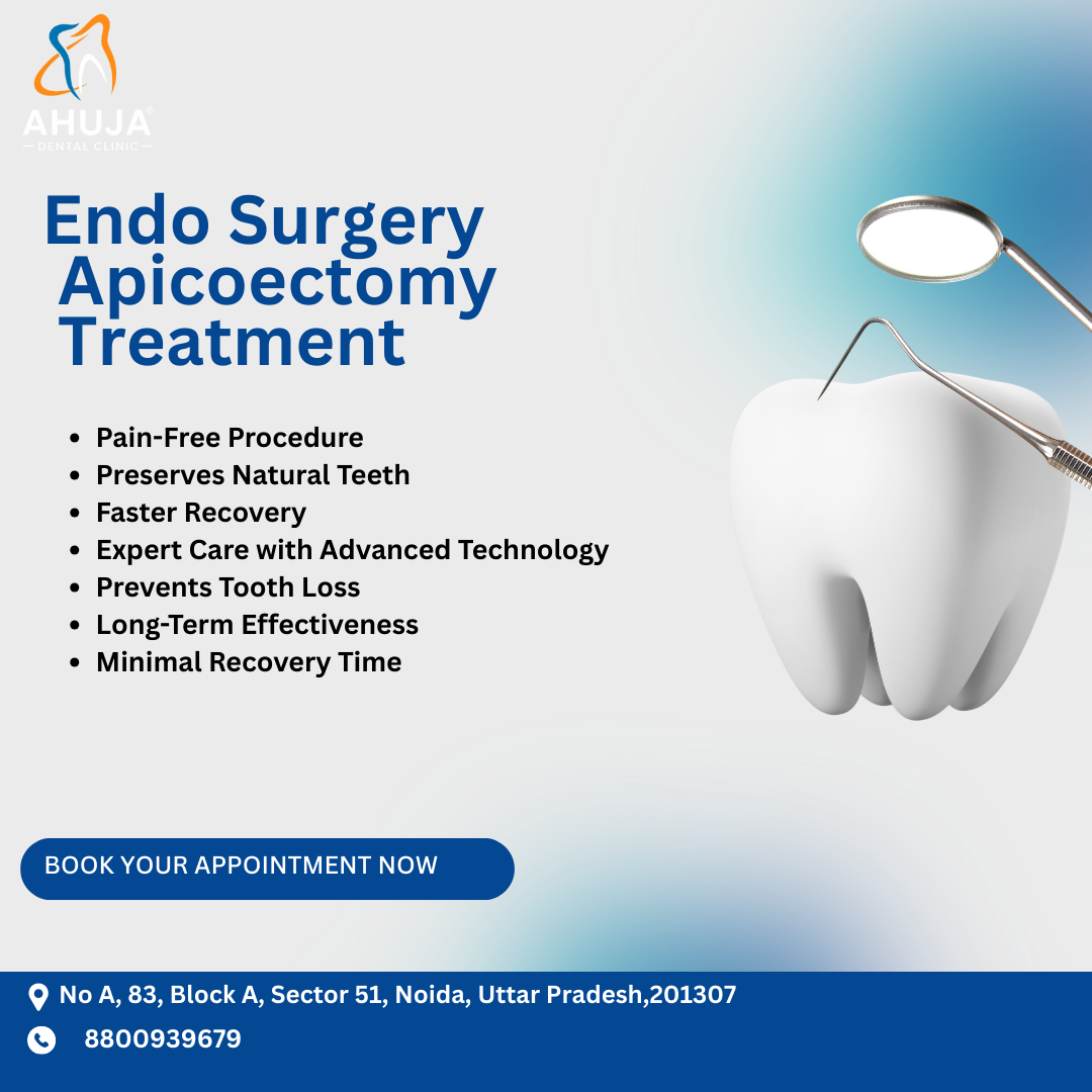 Best painless Apicoectomy Treatment