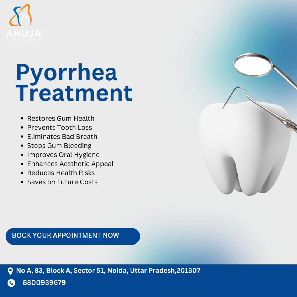 Pyorrhea (Periodontitis) Treatment