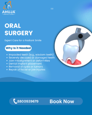 Oral Surgery Image