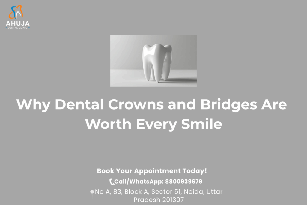 Dental crowns and bridges